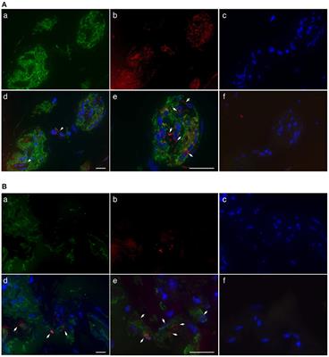 ROCK1 Mediates Retinal Glial Cell Migration Promoted by Acrolein